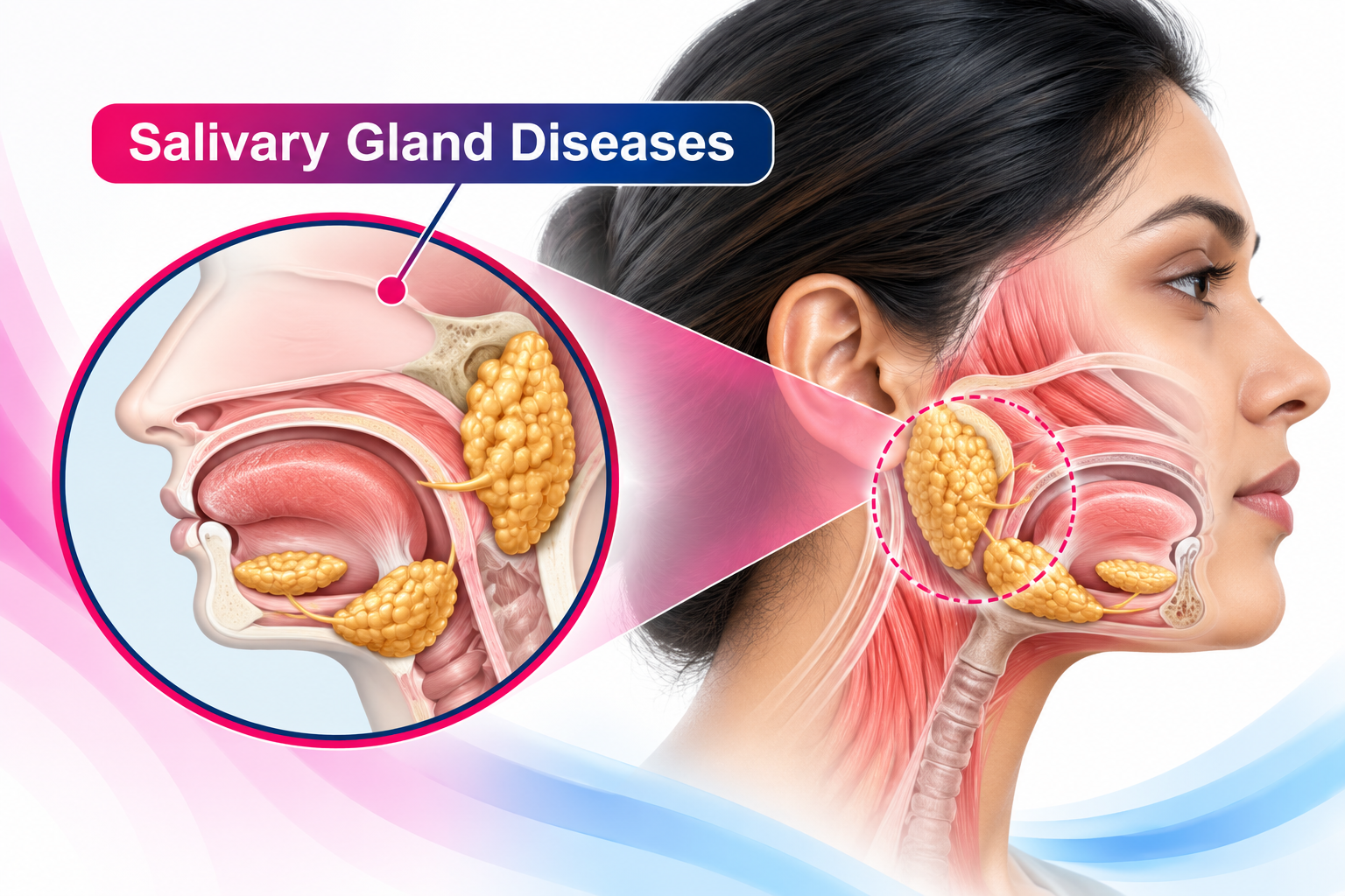 Salivary Gland Diseases